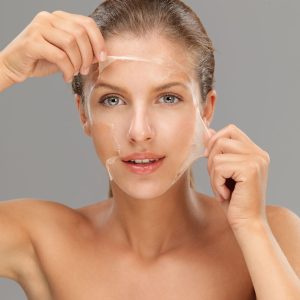 ChemPeel