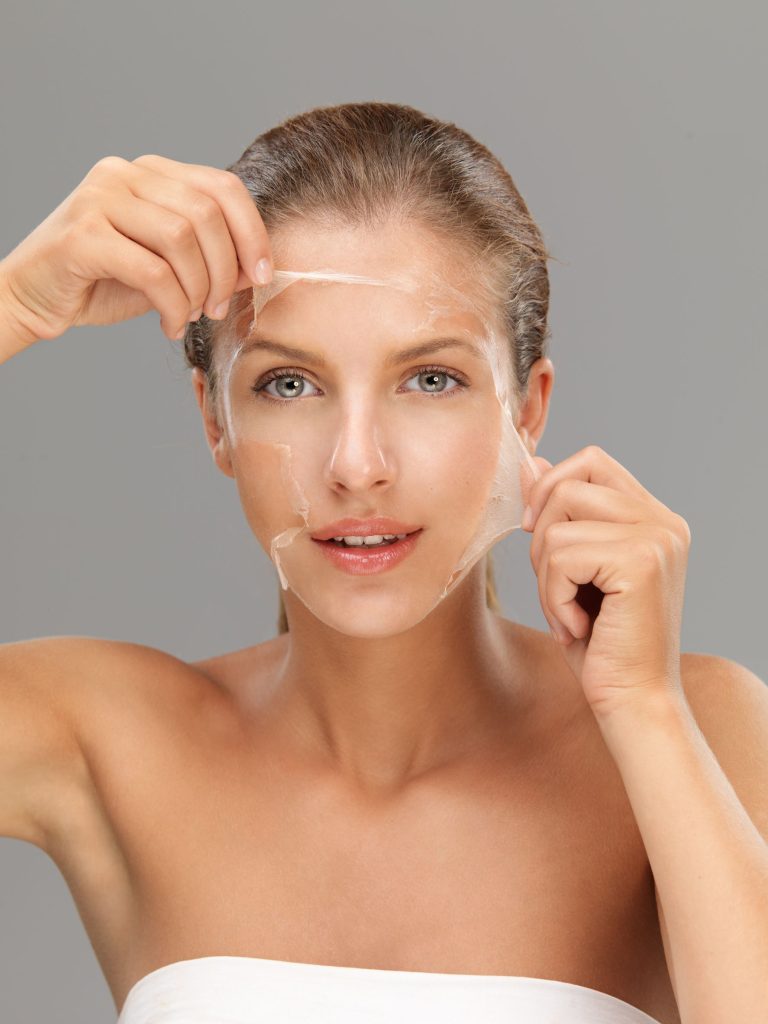 ChemPeel