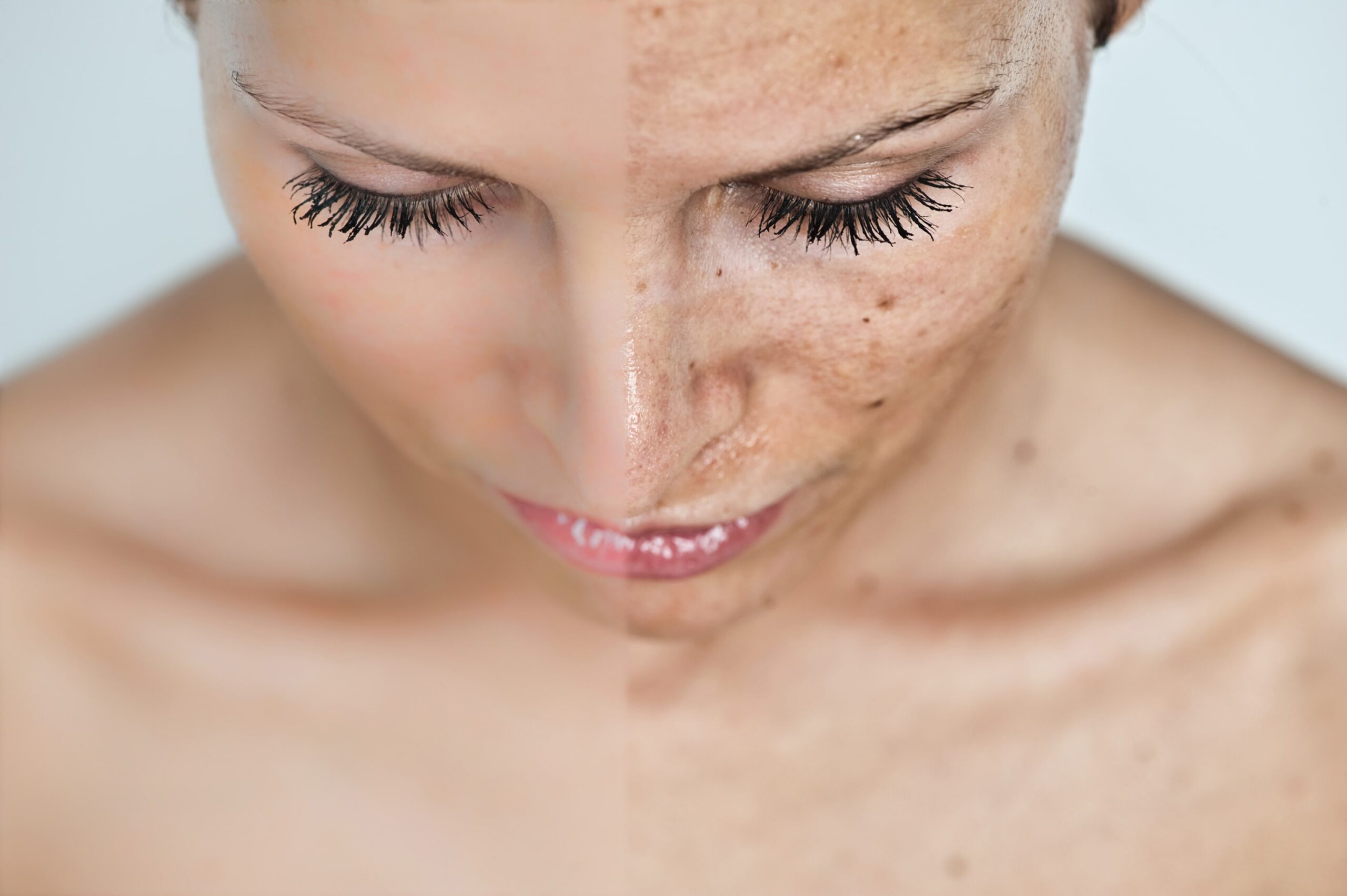 Sun Damage Repair