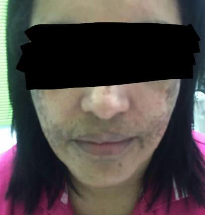 Skin Care for Sensitive Skin