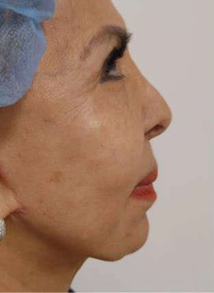 Best Skin Care Treatments