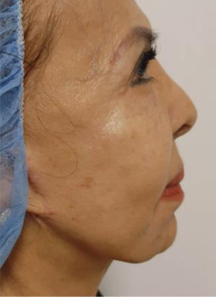 Best Skin Care Treatments
