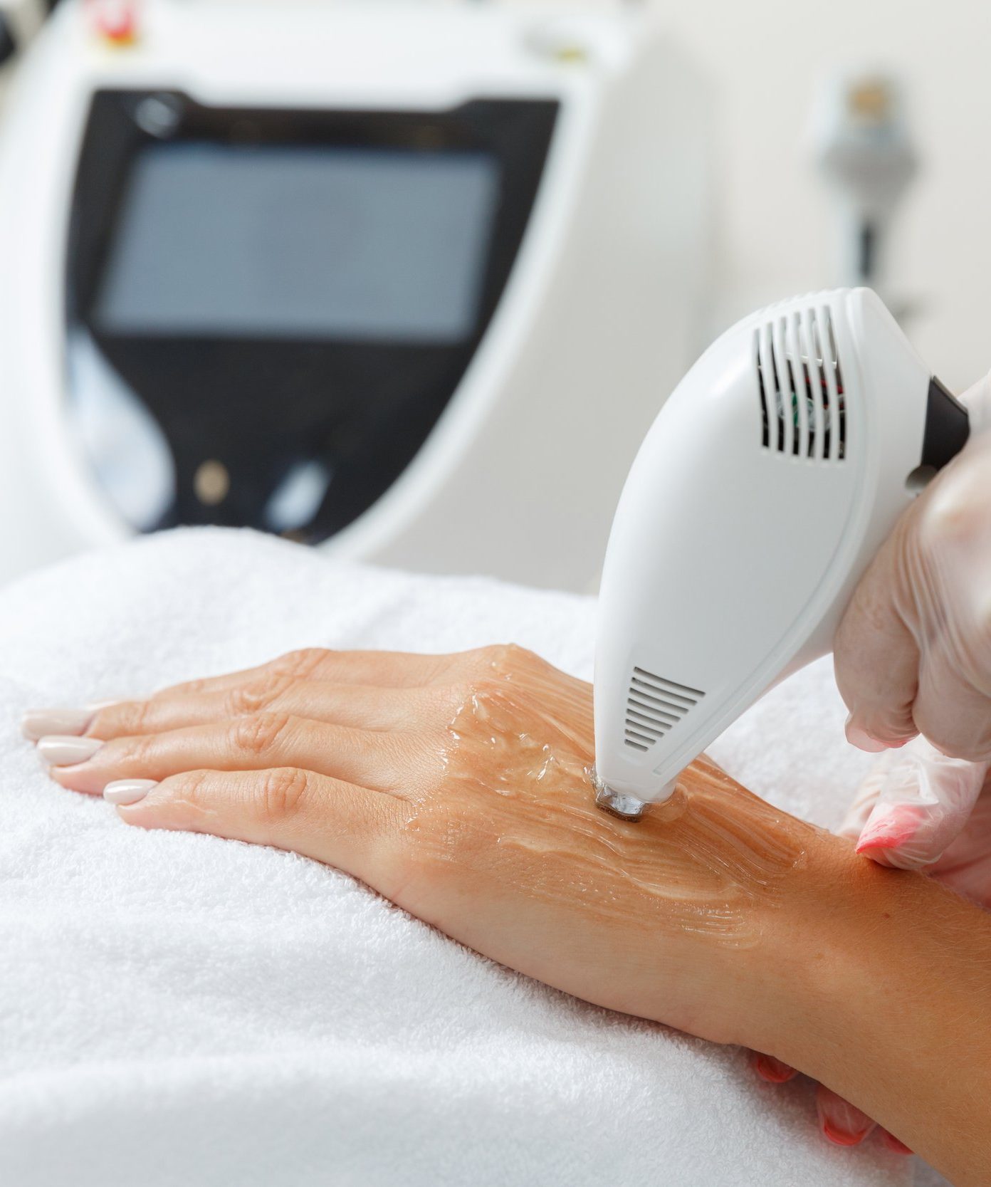 Hands Rejuvenation Treatment