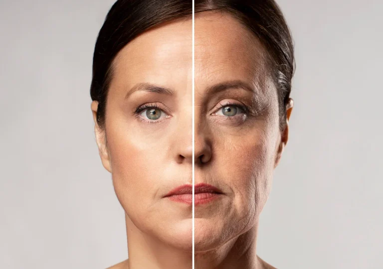 Skin Rejuvenation & Complexion Enhancement