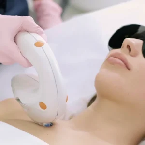 IPL for Skin Rejuvenation