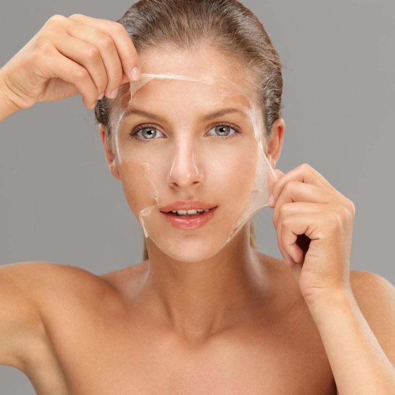 ChemPeel